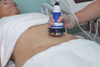 Non-Invasive Lipo/Ultrasound Cavitation & Radio Frequency